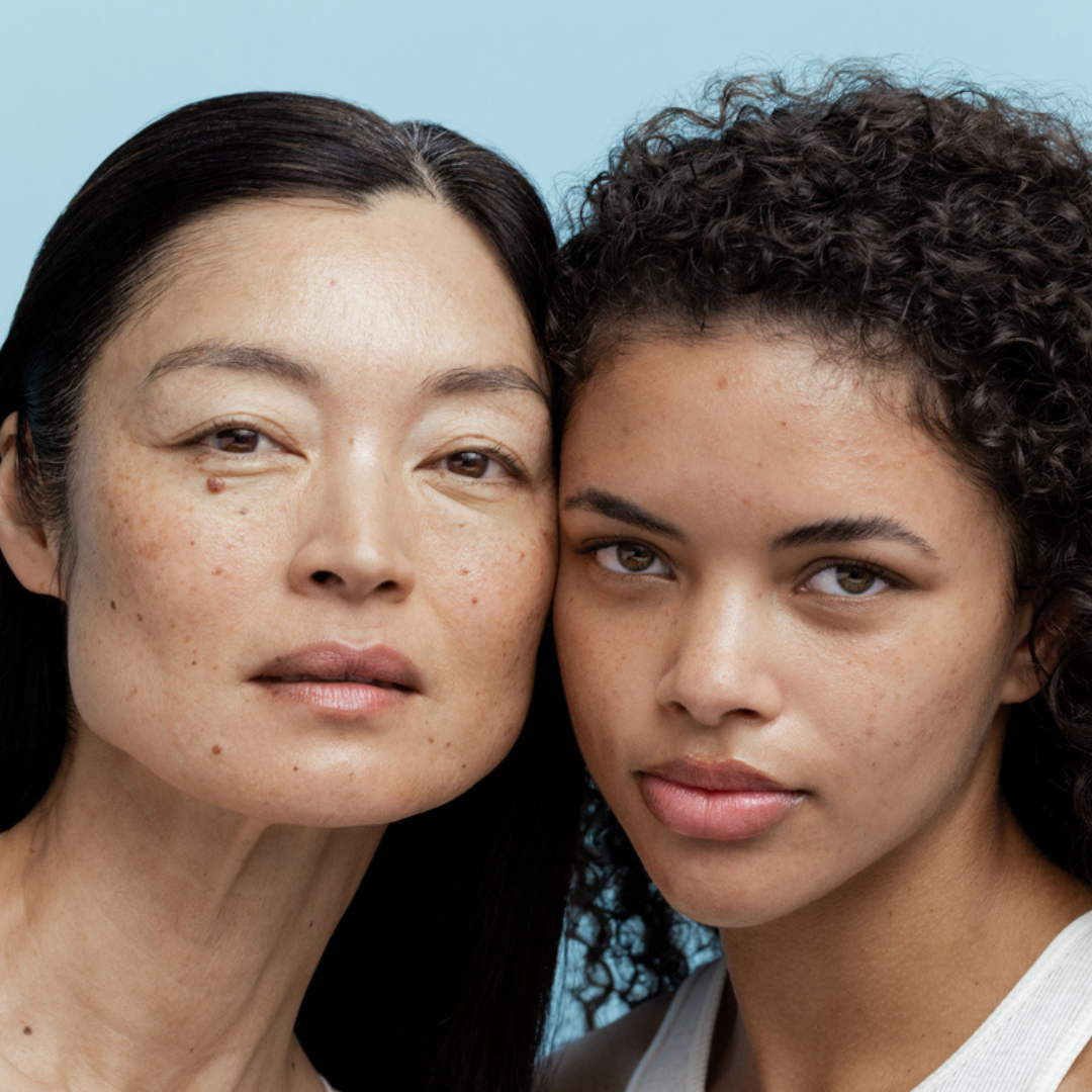 Obagi skin hyperpigmentation and all skin types models