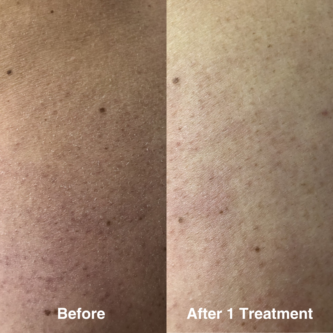 LUXCeuticals Hydro Infusion 480 ml