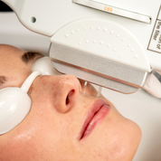 LUXAdapt IPL Spot Size Adapter Set – 5mm Conical & 15mm Square