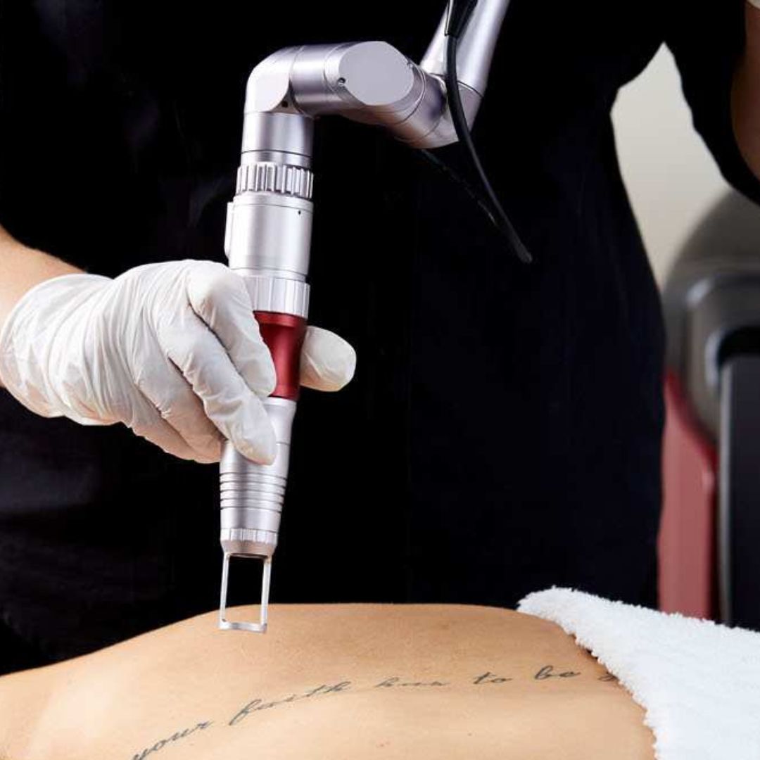 Extended Warranty Tri-Beam