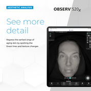 OBSERV 360 Lightmode