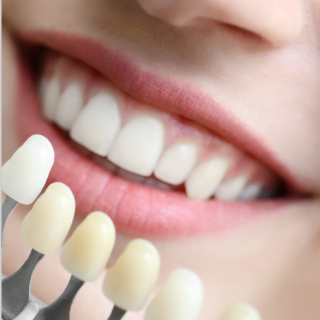 Extended Warranty BrightTonix