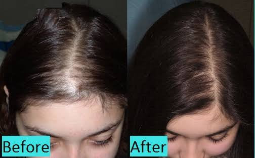 XCellarisPRO Hair Treatment Ampules 8 x 5ml