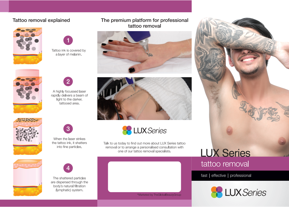 Tattoo Removal Male Brochure
