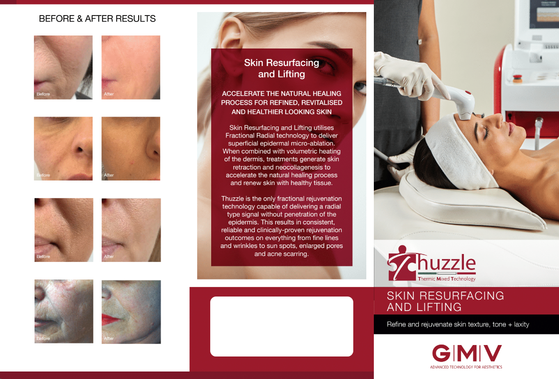 Thuzzle - Skin Resurfacing and Lifting Brochure