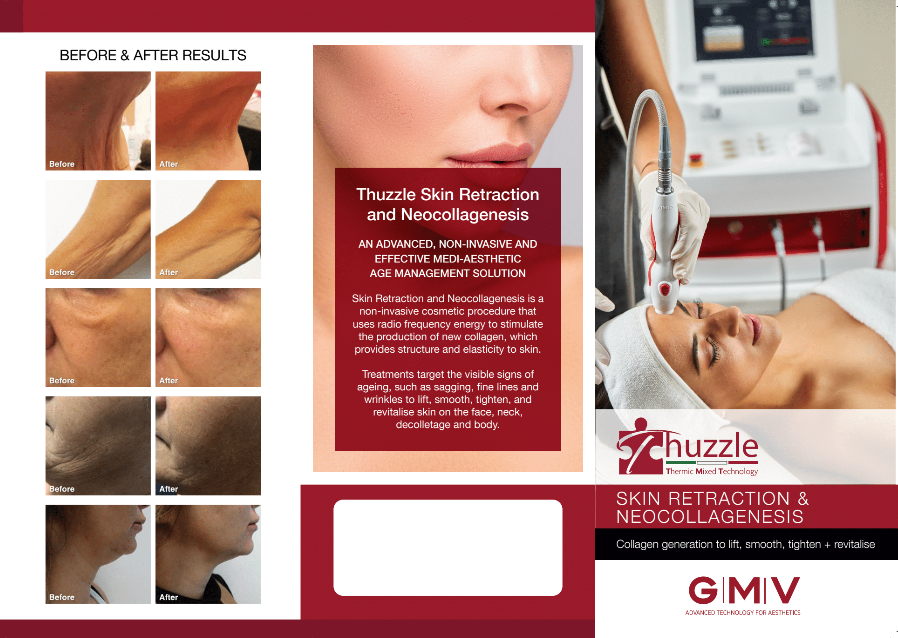 Thuzzle - Skin Retraction and Neocollagenesis Brochure